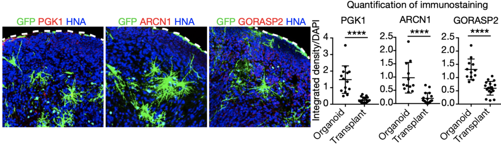 Three immunofluorescent images show brain tissue with GFP (green), marker proteins (red), and HNA (blue), alongside three scatter plots comparing marker intensities between organoid and transplant samples.