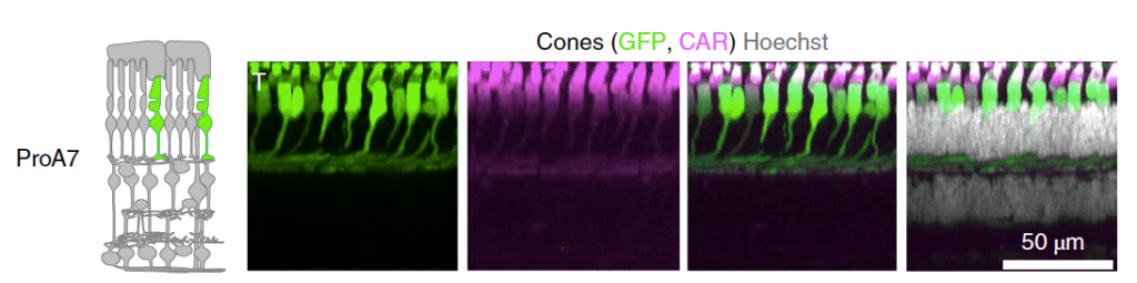 Image of retina cells