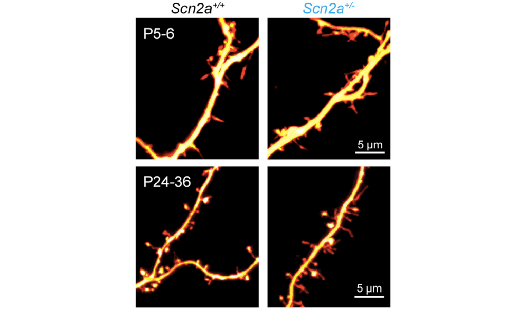 Image of dendrites of pyramidal neurons