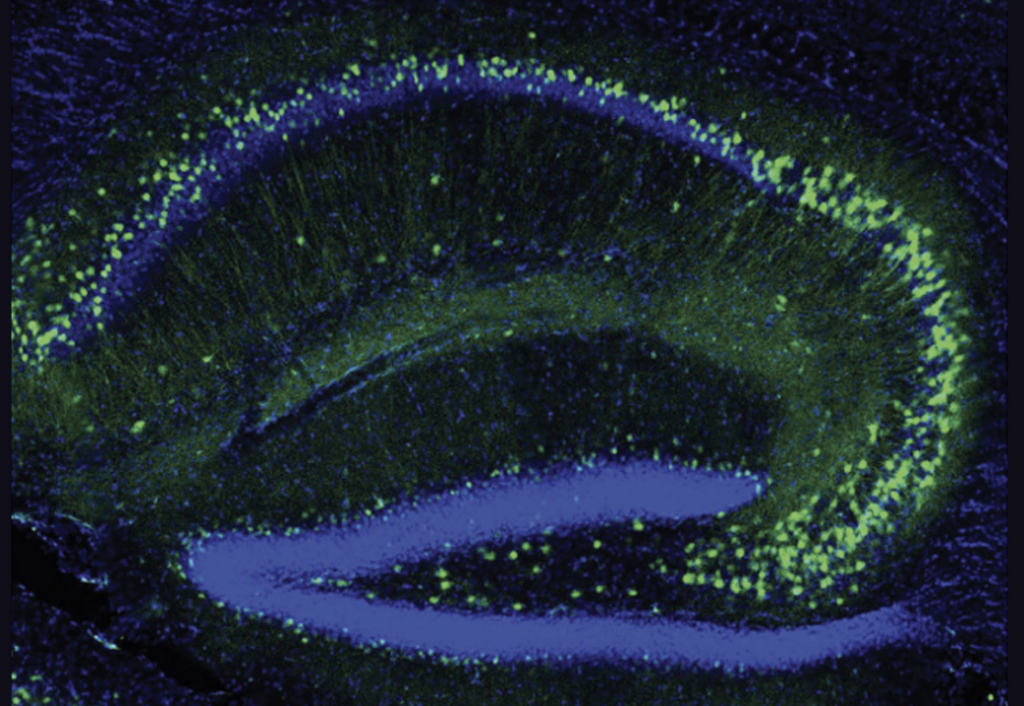 Section of mouse hippocampus showing patterns of expression of Ube3a.
