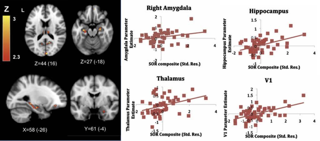 Photo of brain scan images together with 4 graphs depicting plotted information.