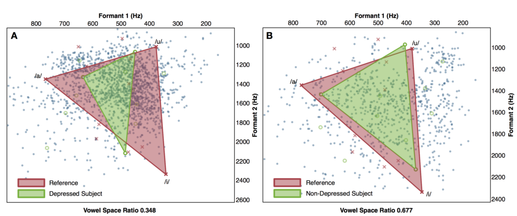Two scatter plots compare vowel formant frequencies for reference and depressed (A) or non-depressed (B) subjects, highlighting the vowel space area outlined by /i/, /a/, and /u/.