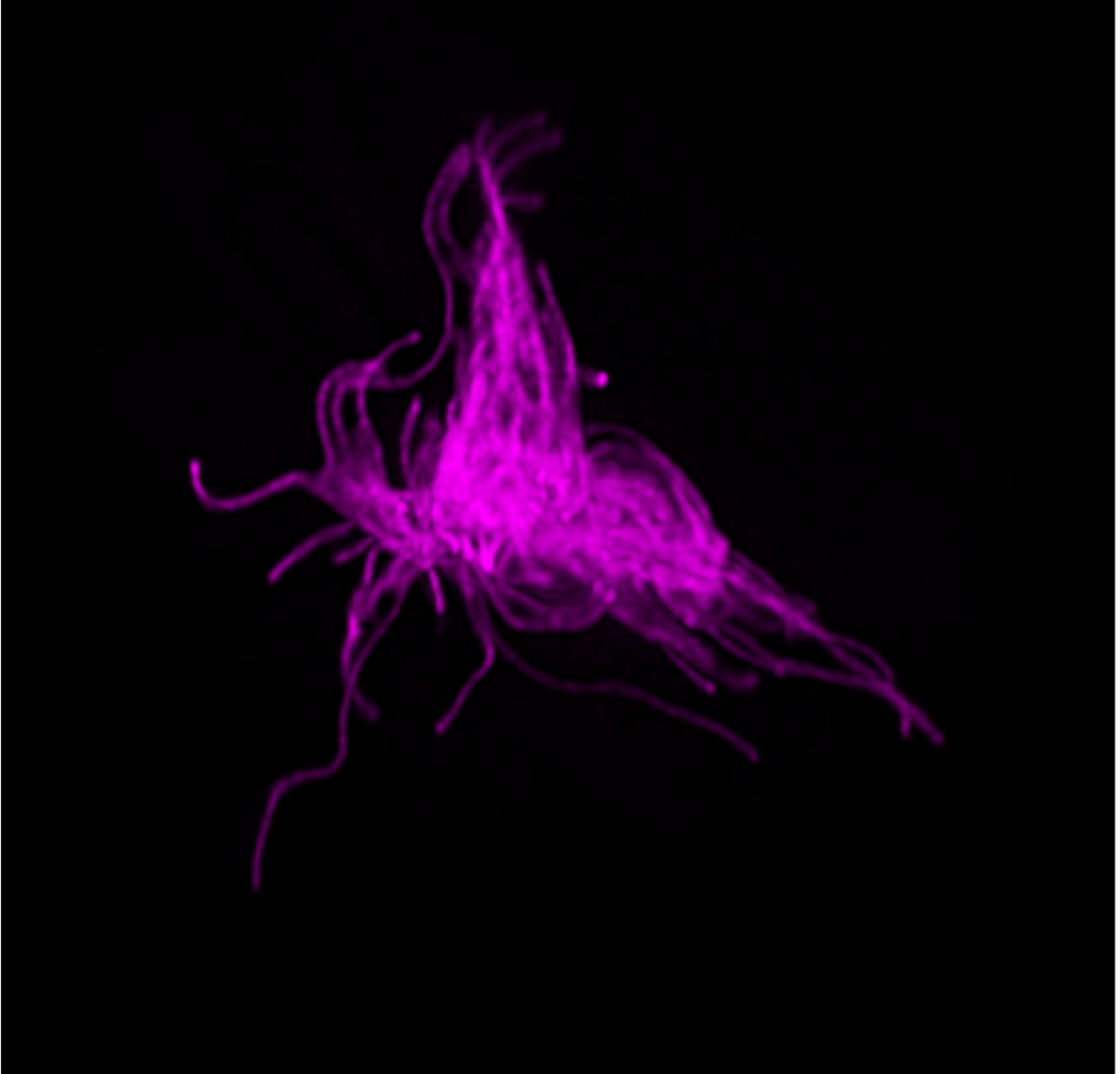 A cluster of glowing, tangled magenta strands appears against a black background, resembling microscopic fibers or filaments observed under a fluorescence microscope.