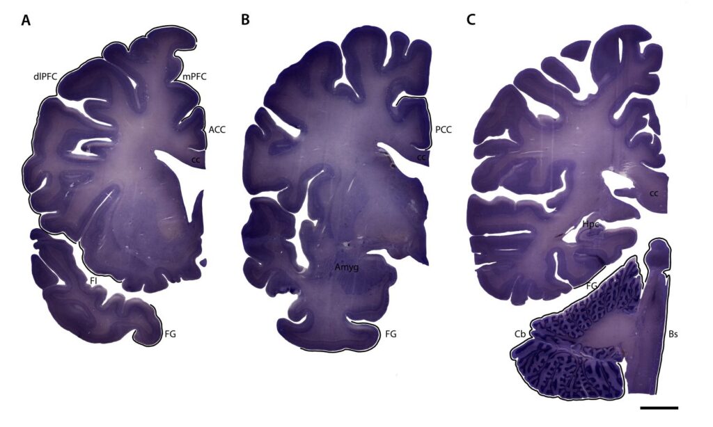 Image of brain slices