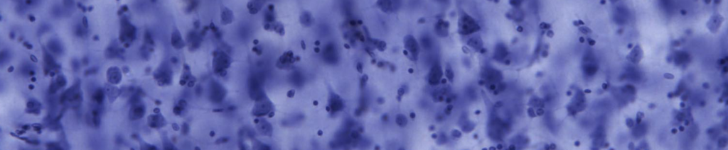 A close-up microscopic image showing many small, dark blue and purple spots scattered across a lighter blue background, resembling stained cells or tissue.