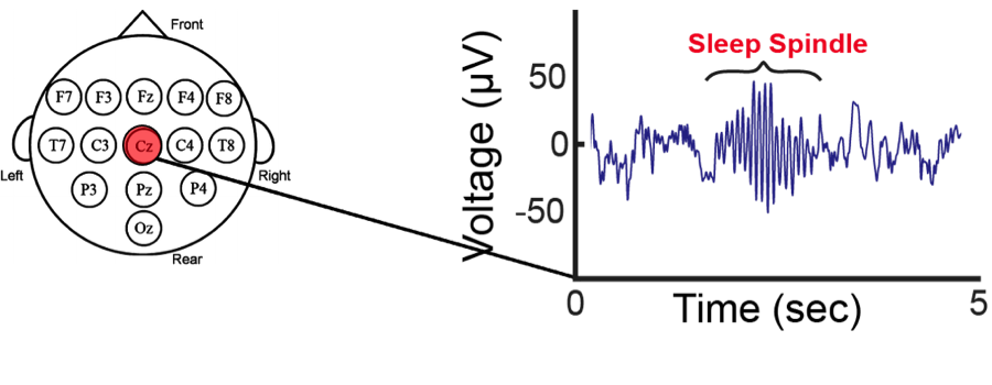 Image of graph