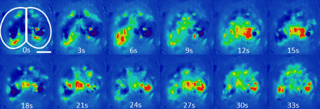 Twelve heatmaps of a pair of lungs over time, labeled from 0 to 33 seconds, show changing colored activity with red indicating intensity. The first image has a lung outline and a white scale bar.