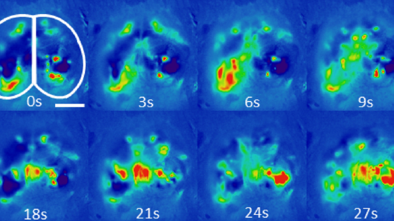 Heat map sequence showing color changes in two lung-shaped regions over eight time points, from 0 to 27 seconds. Colors range from blue to red, indicating intensity changes throughout the sequence.