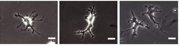 Three grayscale microscope images show branched, star-shaped cells with bright centers and projections. Each image displays different cell shapes and clustering. White scale bars are present in the lower right corners.