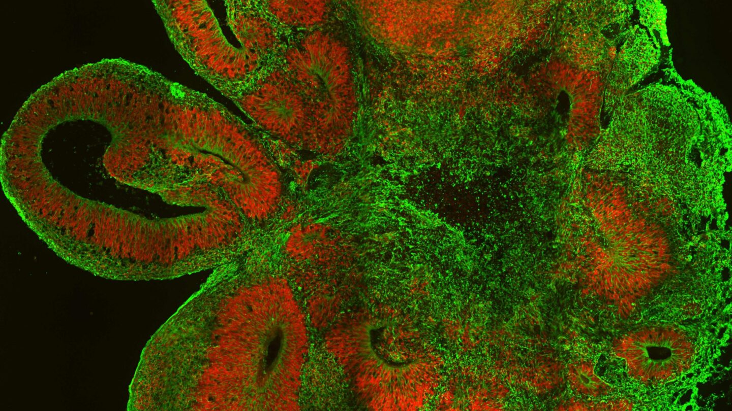 Image from research by Juergen Knoblich.