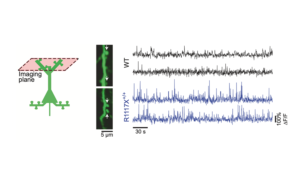 Diagram of a neuron with an imaging plane, images of dendritic spines, and graphs comparing neural activity between WT and R1117X+/−, with the latter showing higher, irregular activity.