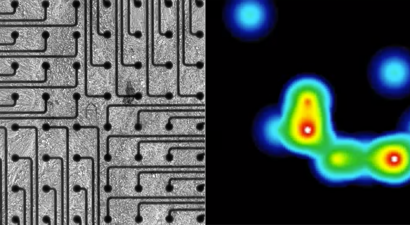 Image of neuron spikes