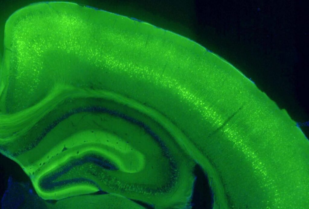 Image of mouse cortex