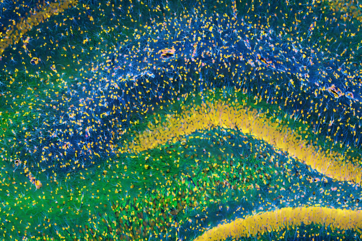 Image of the hippocampus was taken with an ultra-widefield high- speed multiphoton laser microscope.