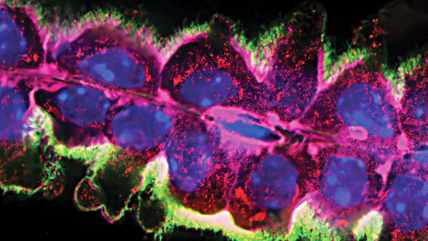 The choroid plexus undergoing apocrine secretion.