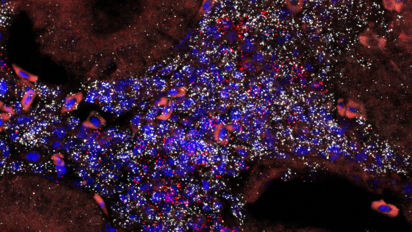 An epifluorescence image of a young male killifish kidney tissue showing the organization of the renal tubules.