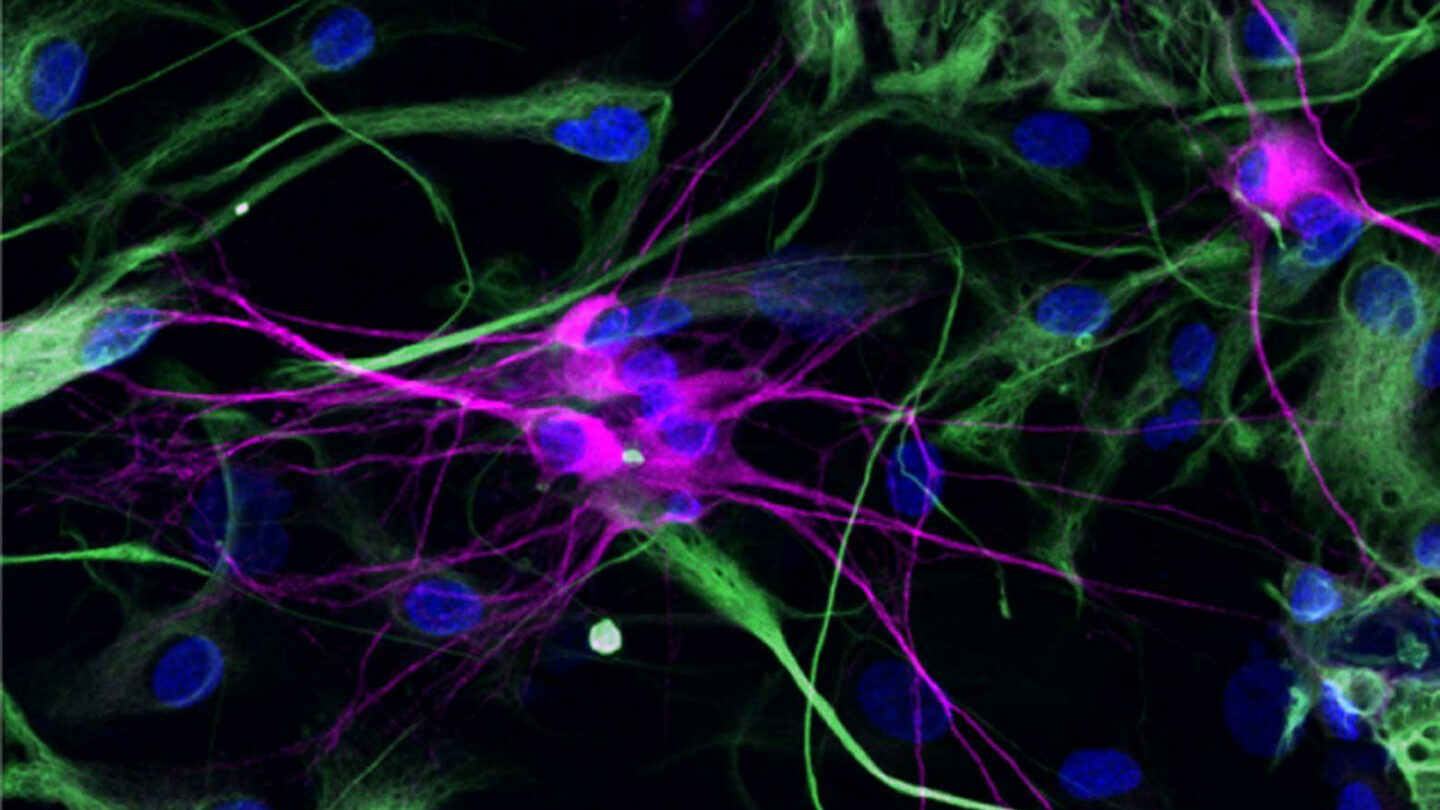 Photo of nerve cells in petri dishes. Neural wires have grown from the cells as they try to connect.