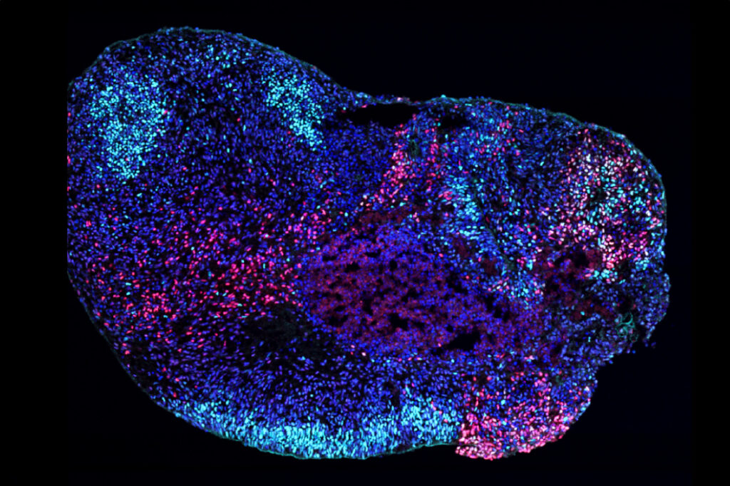A microscopy image of a human stem cell-derived hippocampal organoid.