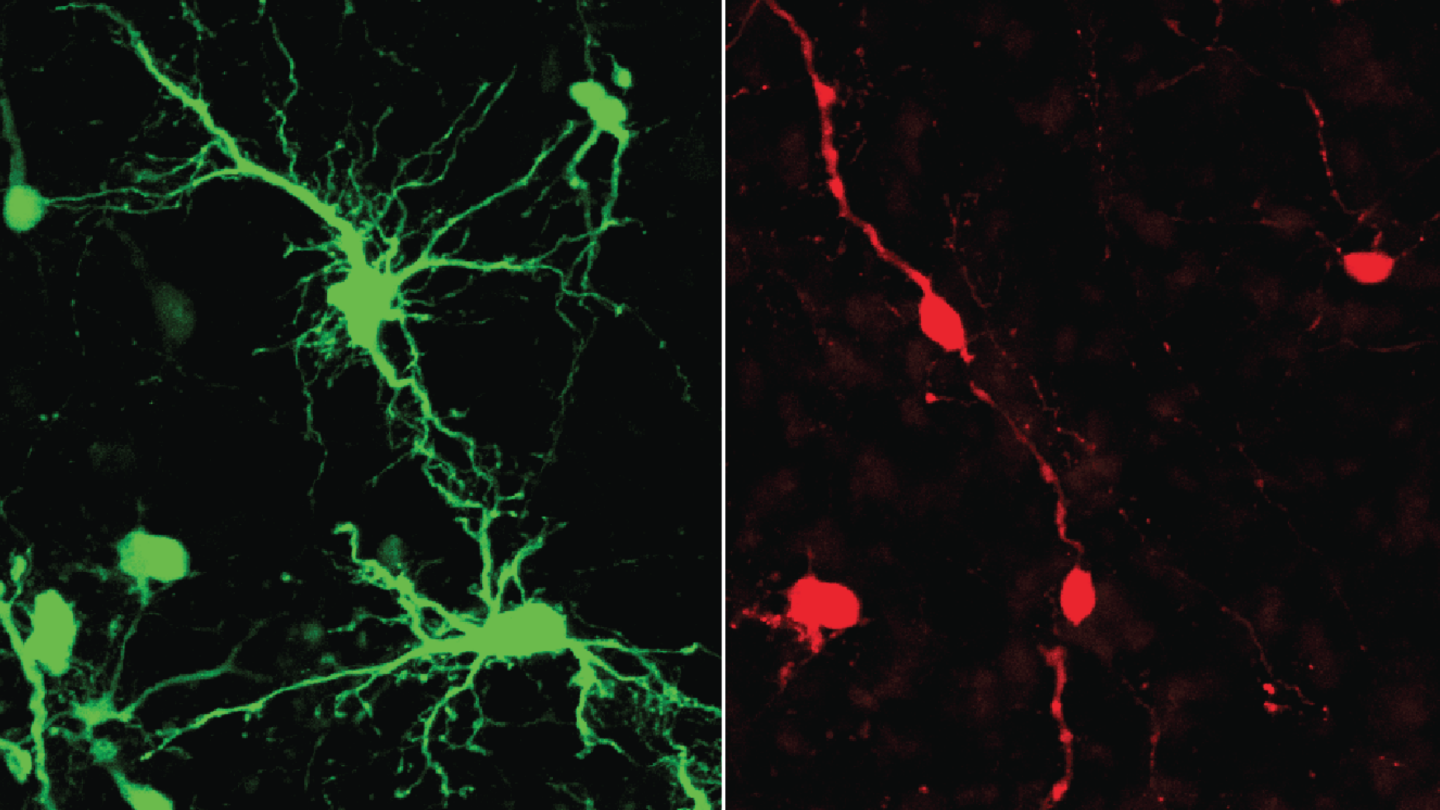 An image of control neurons in the dorsolateral prefrontal cortex of fetal macaque showing their many dendrites, compared to immature neurons that have few dendrites.