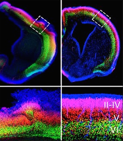 Fluorescent microscopic images show two cross-sections of brain tissue, with color-coded cell layers in green, red, blue, and magenta. Insets below zoom in on the highlighted regions, labeled with roman numerals II–VI.