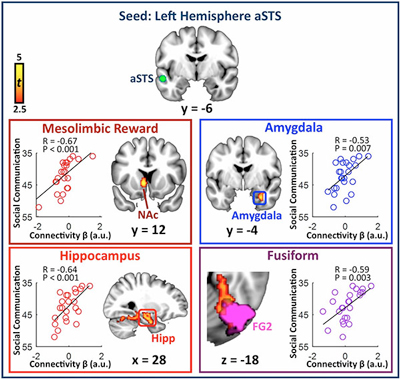 Four brain scan images showing regions related to social communication: Mesolimbic Reward, Amygdala, Hippocampus, and Fusiform, each with connectivity scatter plots and highlighted brain areas.