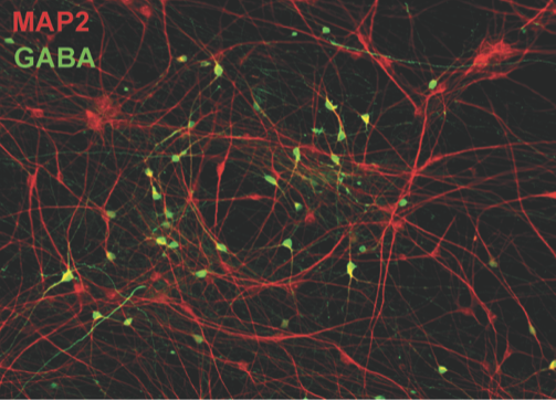 Fluorescent microscopy image showing red MAP2-stained neuron structures and green GABA-positive cells, highlighting neural networks on a black background.