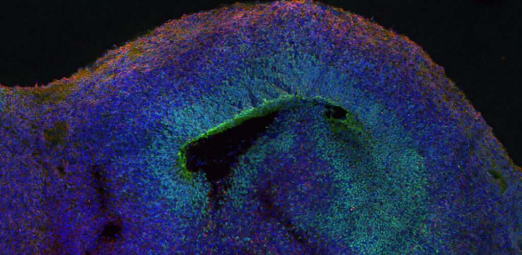 Fluorescent microscopy image of a brain organoid, showing layers of cells in blue, green, and red hues, with a dark central area and a textured, uneven surface.