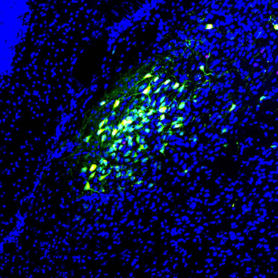 Blue and green fluorescent microscopy image showing dense clusters of cells, with brighter green areas indicating specific cell populations among scattered blue-stained cells.