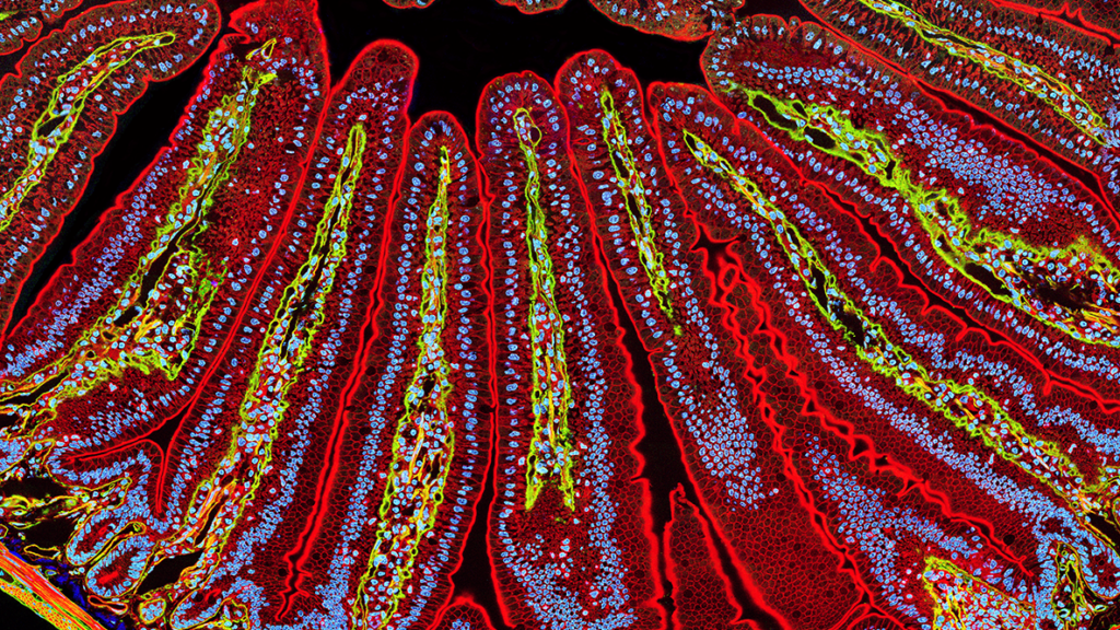 Fluorescent micrograph showing red, yellow, and blue structures of intestinal villi, highlighting tissue layers and cellular details on a black background.