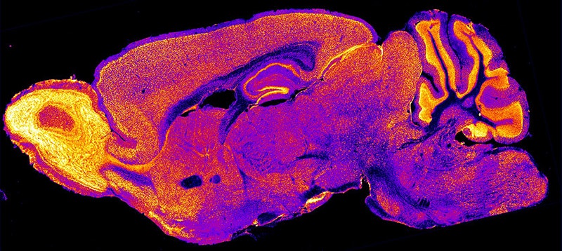 False-color image of a mouse brain slice showing anatomical details in yellow, orange, and purple tones, highlighting different tissue densities. Black background surrounds the brightly colored brain section.