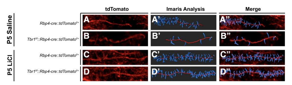 Fluorescent images show neuronal structures in four conditions, with red tdTomato labeling, blue Imaris analysis, and merged panels. Rows compare P5 Saline vs. LiCl and genotypes; columns show original, Imaris, and merged channels.