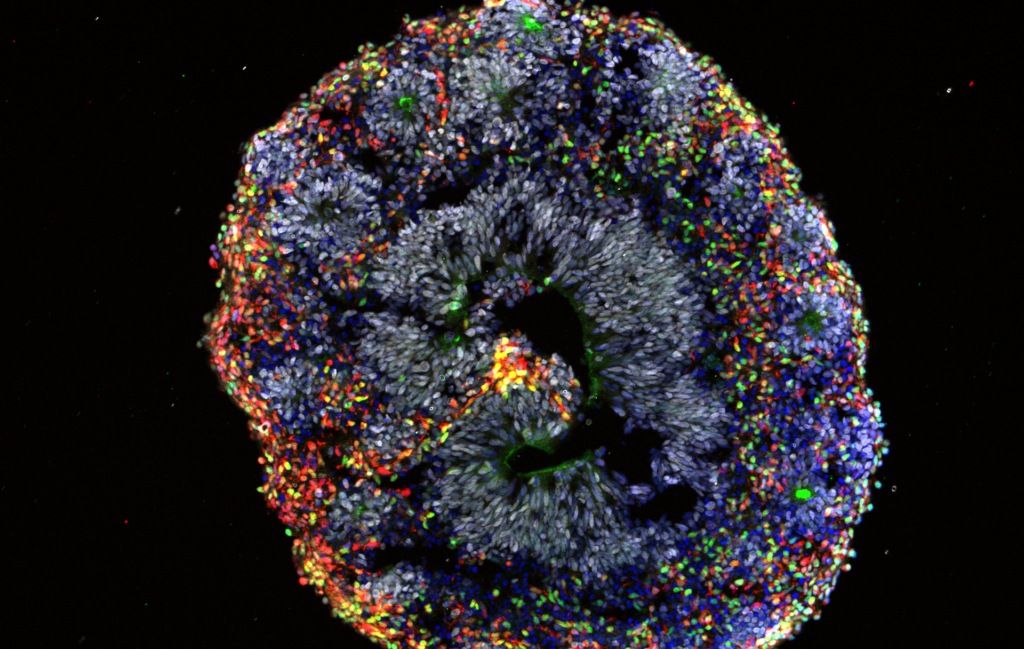 Image of organoid