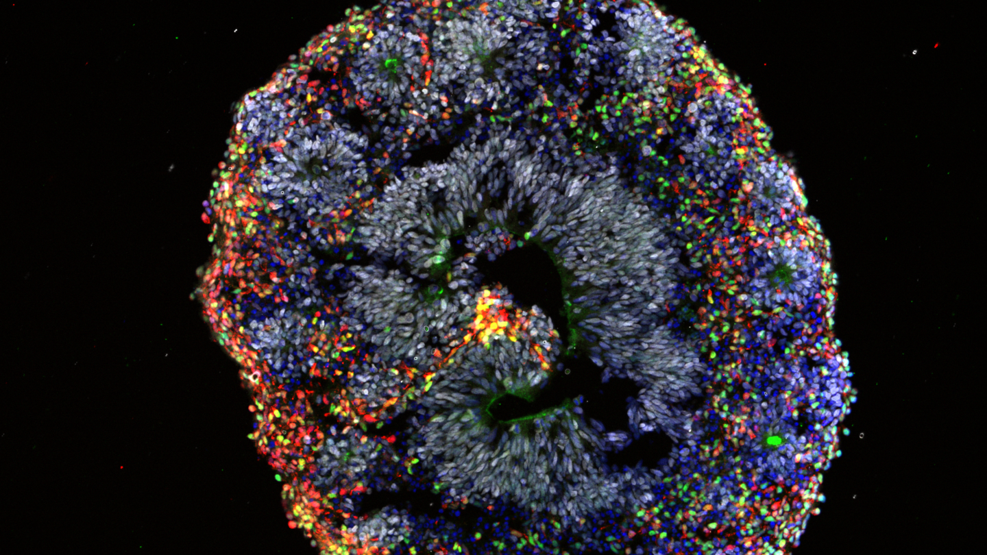 Image of organoid