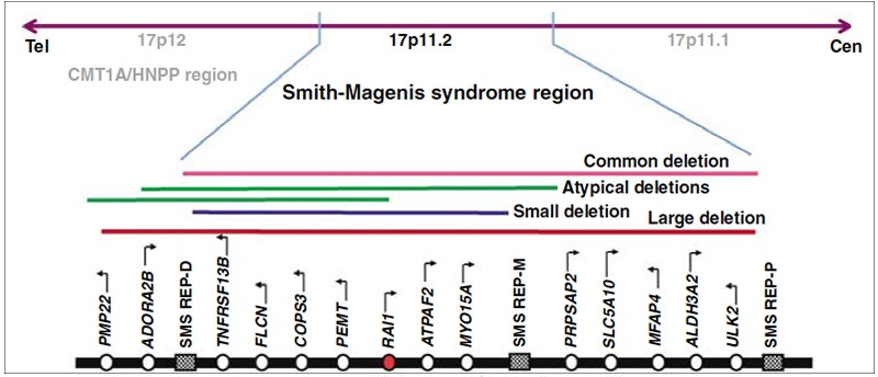 Diagram showing the Smith-Magenis syndrome region on chromosome 17p11.2, with colored lines indicating common, atypical, small, and large deletions across various labeled genes.