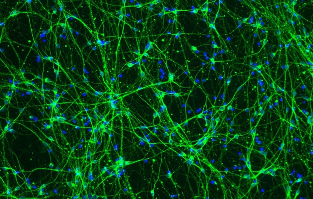 Image of Neurons from stem cells