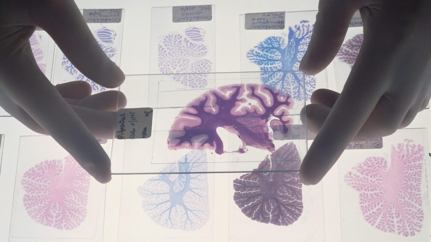 Image of gloved hands hold histological slides of brain tissue on a light box.