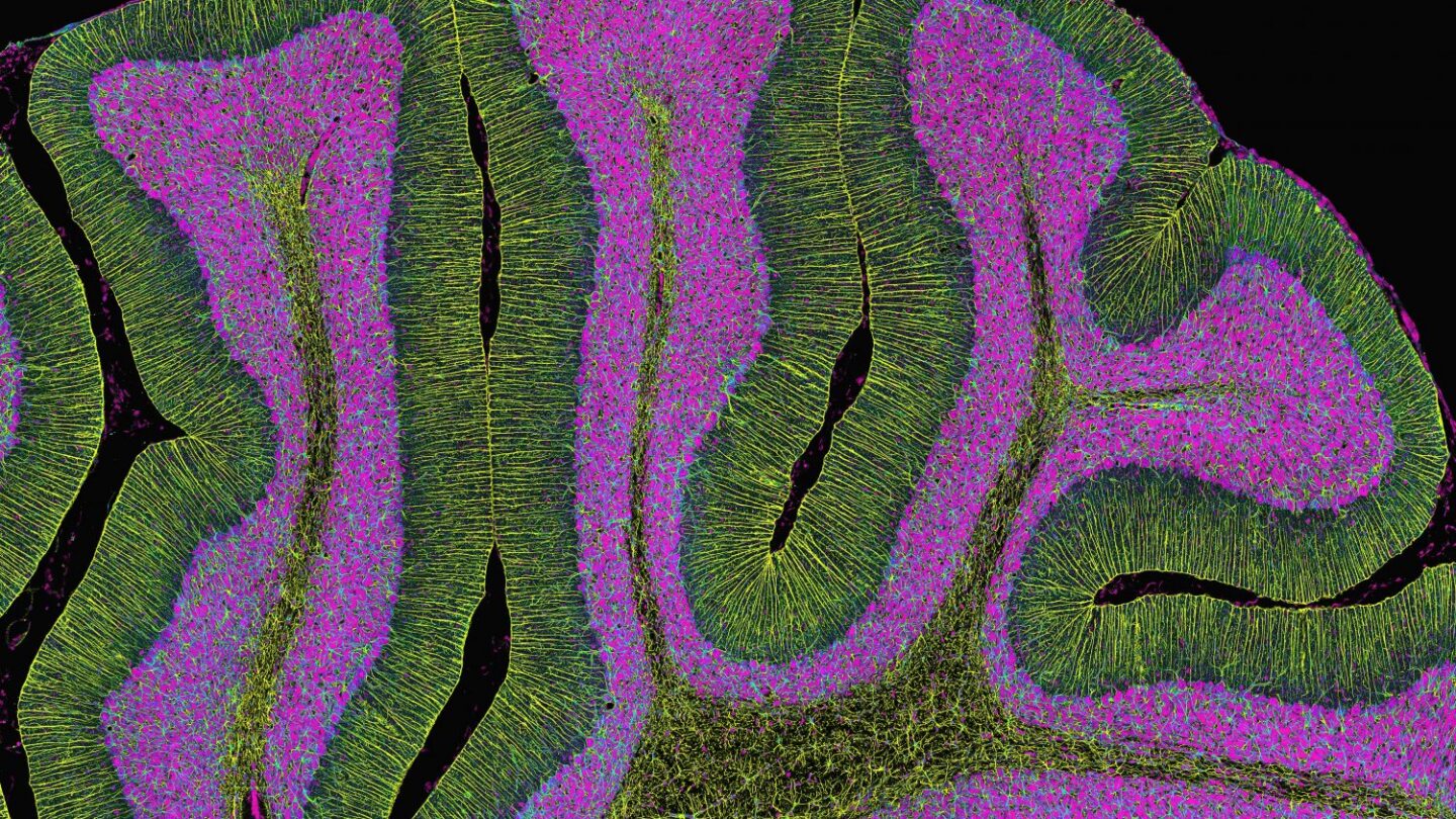 Image of Cerebellum