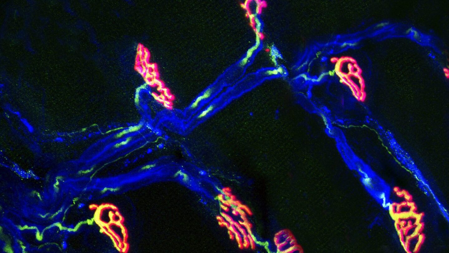 Image of neurons