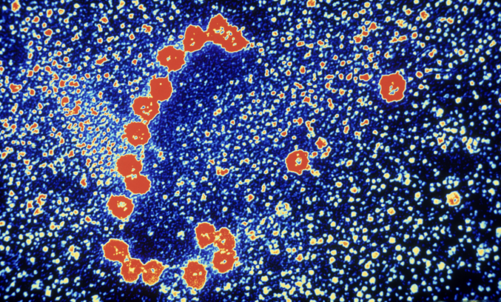 Colored microscopic image showing a cluster of red and yellow round particles against a blue, speckled background, resembling a virus or bacterial cells under magnification.
