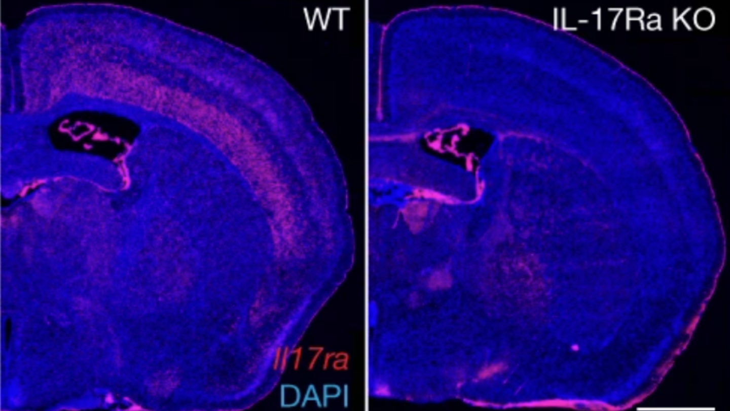Image of brain scan