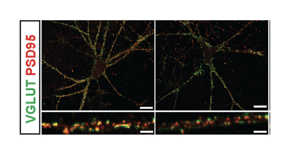 Fluorescent microscopy images show neuron structures with VGLUT (green) and PSD95 (red) labeling. Insets highlight colocalization along the dendrites. Scale bars are visible.