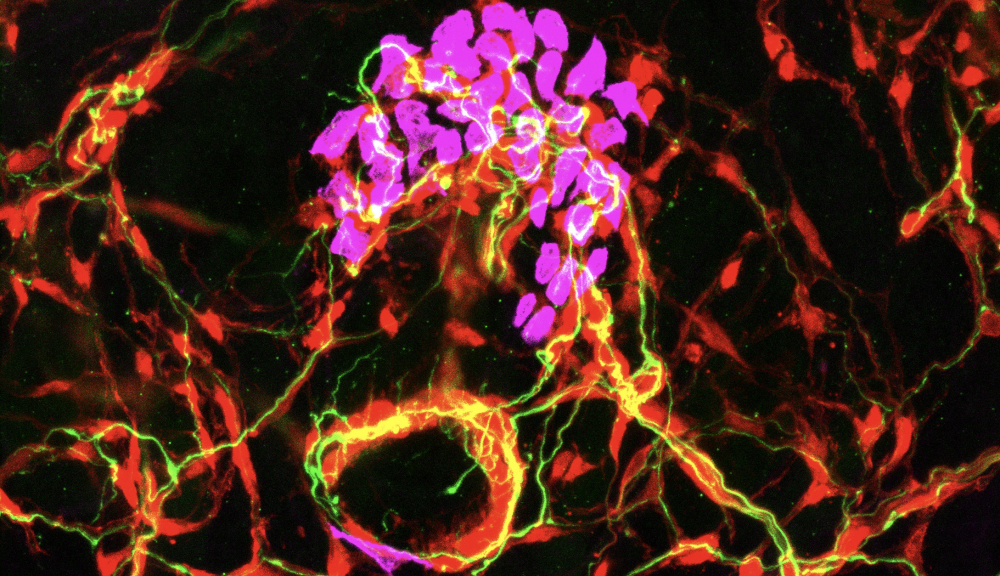 Microscopic image showing red and green nerve fibers surrounding clustered purple cell nuclei, creating a vibrant, web-like pattern on a black background.