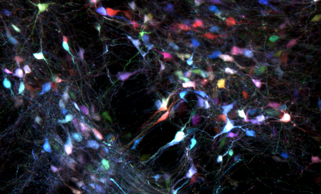 Colorful glowing neuron-like cells scattered across a dark background, with thin branching structures connecting them, resembling a neural network or brain tissue viewed under a microscope.
