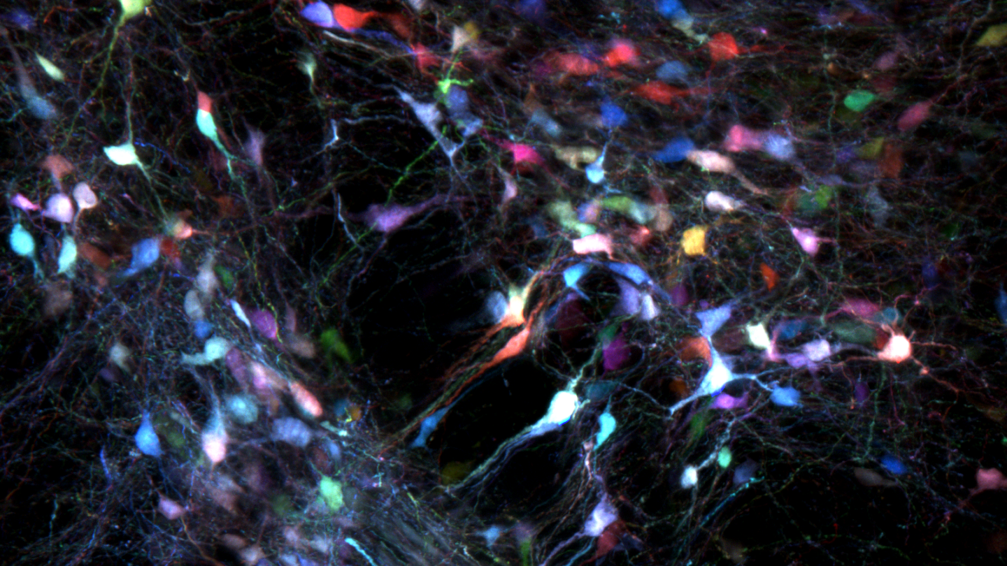 Colorful glowing neuron-like cells scattered across a dark background, with thin branching structures connecting them, resembling a neural network or brain tissue viewed under a microscope.