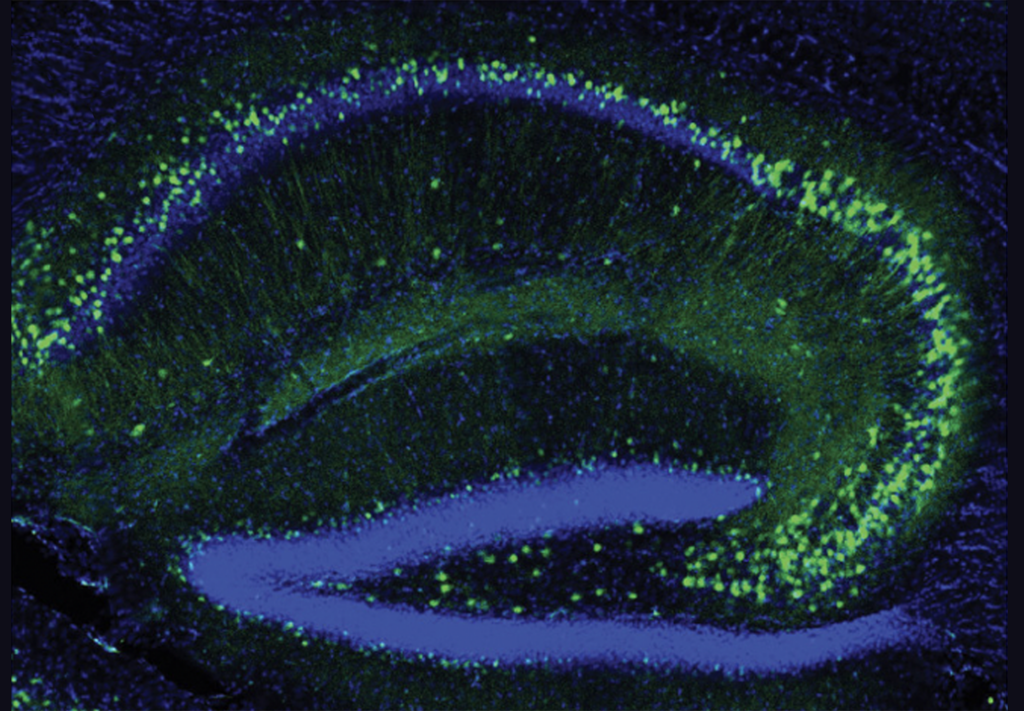 Image of neurons in a mouse brain.