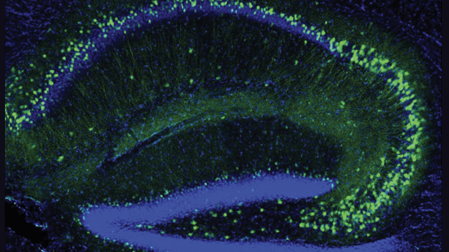 Image of neurons in a mouse brain.