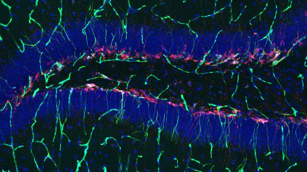 Fluorescent microscopy image of brain tissue showing blue, green, and red stained neural cells and fibers, with dense cell clusters and branching structures against a dark background.