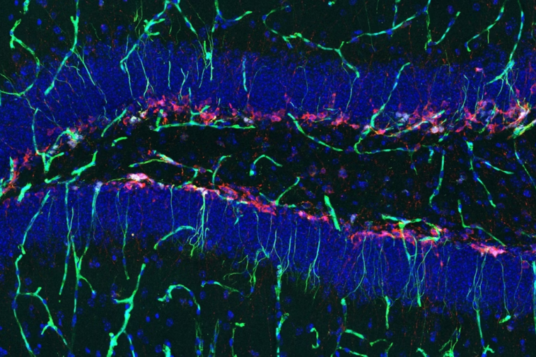 Fluorescent microscopy image of brain tissue showing blue, green, and red stained neural cells and fibers, with dense cell clusters and branching structures against a dark background.