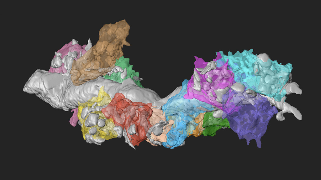 A 3D model of clustered, irregular shapes in various colors—including white, brown, blue, purple, yellow, and green—on a black background, resembling a scientific or medical visualization.