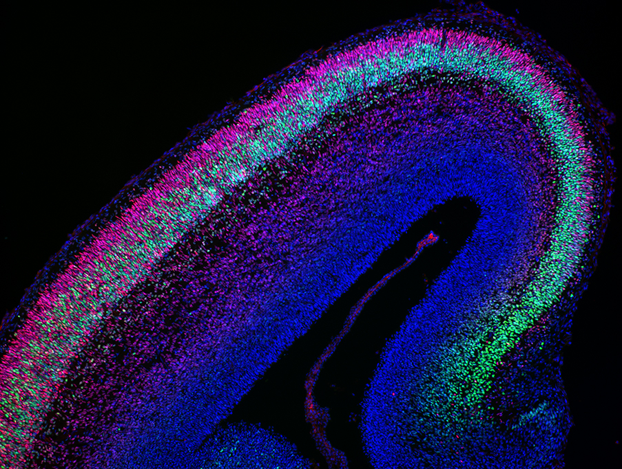 A fluorescent microscopic image shows layers of brain tissue in blue, green, and pink, highlighting different cell types and structures, against a black background.